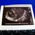:iconfresa98106: