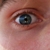 :iconfrostigt: