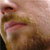 :iconfynamite: