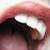 :icong-melloncollie: