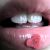 :icongallowsgirl: