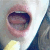 :icongioakkina: