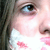 :iconglowingplacebo: