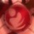 :iconhail-cyclonia: