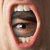 :iconHappyDisaster: