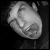 :iconimarrgh: