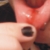 :iconinfectiouscarnage: