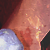 :iconinterfuse: