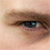 :iconinurfac3: