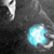 :iconjackallsopp: