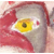 :iconjackcramps: