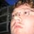 :iconJMeasles: