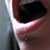 :iconkandyce: