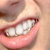 :iconkayleighnesss: