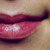 :iconketis: