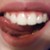:iconkreativlosigkeit: