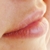 :iconlaughter-lightness: