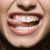 :iconlovedreamers: