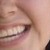 :iconlyzd: