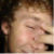 :iconmathanial: