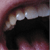 :iconmbrouwer: