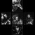:iconMDK187: