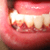 :iconmephistorey: