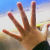 :iconmeredithpox: