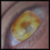 :iconmichaelspringer: