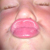 :iconmilsten: