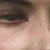 :iconmorbidose: