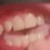 :iconmrnoinch: