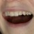 :iconmylittleguillotine: