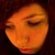 :iconmyxomatosiss: