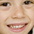 :iconnachester:
