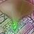 :iconnemotocyst: