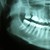 :iconnick-teeth: