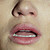 :iconnoatthetopofourlungs: