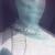 :iconnormanium: