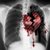 :icononly-ashes-now: