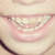 :iconorangephotography: