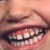 :iconordito: