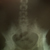 :iconperpetualnovember: