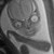 :iconphloxy: