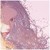 :iconpink-foxx: