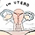 :iconplacentuhhh:
