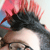 :iconpnemothorax: