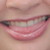 :iconpunkemometal: