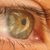 :iconr-t-m: