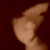:iconredrumdog: